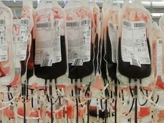 Blutbeutel: Es besteht immer Bedarf an Spenden.