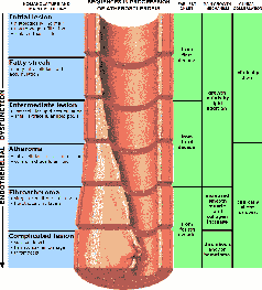 Schematisch: Phasen der Atherosklerose