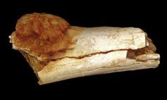 Fossile Zehe: Krebs nachgewiesen. Bild: Patrick Randolph-Quinney, UCLAN
