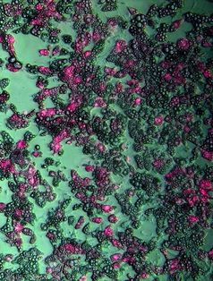 Braune Fettzellen in Kultur. In den rosa gefärbten Zellen wurde das Sufu-Gen blockiert. Abbildung: IMBA
