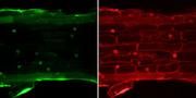 Nur im Zellkern aktiv: Gekoppelt an ein grün fluoreszierendes Protein leuchtet „SP7“ unter dem UV-Licht auf (links), andere Proteine verteilen sich gleichmäßig (rechts). (Abb. Botanisches Institut).
