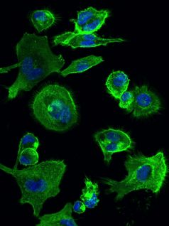 Diese Immunzellen exprimieren den betreffenden Rezeptor. Kern und Cytoskelett sind gefärbt.
Quelle: Claudia Stäubert (idw)