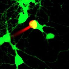 Eine einzelne Immunzelle (rot) nimmt Kontakt auf mit einer Nervenzelle (grün) und löst dort einen "Kurzschluss" aus. Foto: Forschungsgruppe Multiple Sklerose und Neuroimmunologie