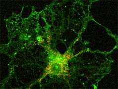 Grün gefärbt sieht man eine Gliazelle (Oligodendrozyte) in Zellkultur, die aus Mausgehirn am Tag der Geburt gewonnen wurde. Rot gefärbt sind die Peroxisomen. Bild: Max-Planck-Institut für Experimentelle Medizin