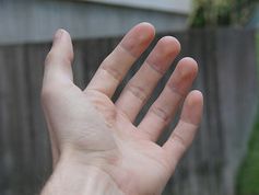 Hand: Prothese stellt Gefühl in den Fingern wieder her. Bild: flickr.com/mnsc
