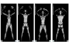 Nachtscanner: Geräte können die Bilder im Testmodus weiterverarbeiten. Bild: tsa.gov