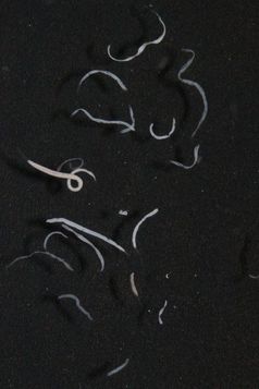 Mehrere Wimperntierchen aus Mittelmeer unter dem Mikroskop. Der Schwefel in den symbiontischen Bakterien reflektiert das Licht und sorgt für die helle Farbe. Quelle: Oliver Jäckle, MPI Bremen (idw)