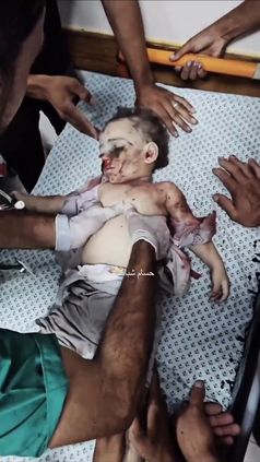 Zustände im Gaza-Streifen (2024)