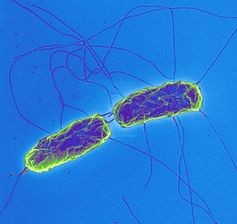 Abb. 1: Salmonella typhi Bild: Dr. Volker Brinkmann, MPI für Infektionsbiologie