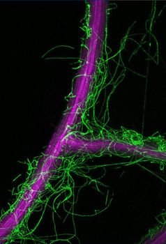 Mikroskopischer Ausschnitt einer Arabidopsis thaliana-Wurzel (violett), die mit Pilzgeflecht von Colletotrichum tofieldiae (grün) umgeben ist. Quelle: MPI f. Pflanzenzüchtungsforschung (idw)