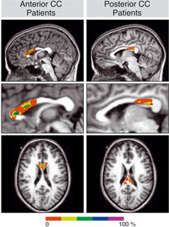 Bild: Max-Planck-Institut für Kognitions- und Neurowissenschaften