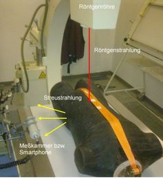 Versuchsaufbau: Mit einem C-Bogen wurde ein patientenäquivalentes Phantom mit Röntgenstrahlung durchleuchtet (roter Pfeil). Die dabei entstehende Streustrahlung (gelbe Pfeile) konnten mit einer geeichten Messkammer bzw. dem Smartphone nachgewiesen werden. Dr. Georg Stamm (Mediz. Hochschule, Institut für Diagnostische und Interventionelle Radiologie)