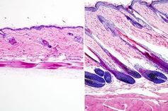 Gestoppter (links) und aktivierter Haarwuchs. Bild: UCLA Broad Stem Cell Center