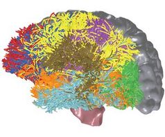 Neuer Algorthmus vermisst Verbindungen im Gehirn. Bild: IBM Research