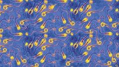 Spermien: Funktionierende Zellen werden "gelagert". Bild: SPL