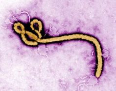 Ebola: Molekül-Computer erkennt Virus schnell. Bild: cdc.gov