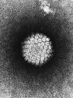 HPV im Elektronenmikroskop.