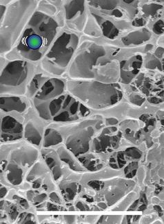 Wie an den Gitterstäben eines Käfigs bleiben Nanopartikel an den steifen, dicken Gelstäben im Lungenschleim hängen.
Quelle: Abbildung: Schneider/Kirch et al. (idw)
