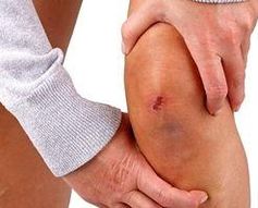 Knie: muss viele Belastungen ertragen. Bild: pixelio, Thomas Siepmann