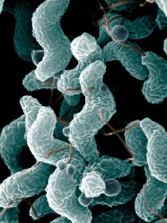 Campylobacter jejuni