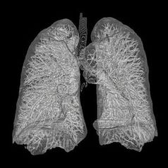 3D-Rekonstruktion menschlicher Lunge aus CT-Bildern Bild: AndreasHeinemann at Zeppelinzentrum Karlsruhe, Germany http://www.rad-zep.de / de.wikipedia.org
