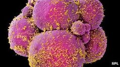 Embryos: Zellen teilen sich bei Raucherinnen langsamer. Bild: SPL