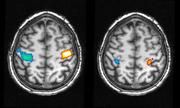 Aktivität in der motorischen Hirnrinde bei einer tatsächlich ausgeführten Bewegung der Hände im Wachen (linkes Bild) und während einer geträumten Bewegung (rechtes Bild). Blaue Regionen spiegeln die Aktivität bei einer Bewegung der rechten Hand wider, die in der linken Gehirnhälfte deutlich wird, wohingegen rote Regionen die entsprechende Bewegung der linken Hand auf der gegenüberliegenden Hirnhälfte anzeigt. MPI für Psychiatrie