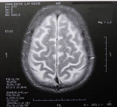 MRT: Unmenge an neuen Daten über das Gehirn. Bild: pixelio.de, Dieter Schütz