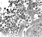 Elektronenmikroskopische Aufnahme von Lassaviruspartikeln. BNI