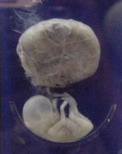 3 Monate alter Fetus mit Nabelschnur und Plazenta.