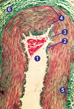 Querschnitt durch eine menschliche Arterie vom elastischen Typ: (1) Lumen mit einigen Erythrozyten, (2) Tunica intima, (3) Membrana elastica interna, (4) Tunica media, (5) Membrana elastica externa, (6) Tunica adventitia/ externa