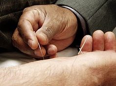 Erst allmählich wird erforscht, was Akupunktur im Körper bewirkt. Bild: Wikimedia Commons