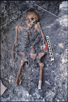 Der Backenzahn gehört zu dem 14.000 Jahre alten Skelett, das 1988 in der Felshöhle von Riparo Villabruna in Norditalien gefunden wurde. Quelle: A. Broglio (idw)