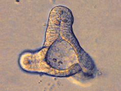 Viertelmillimeter große Organoide wie dieser eingefärbte Mini-Darm zeigen essentielle Funktionen eines echten Darms. Quelle: (Foto: TUM/ Zietek) (idw)