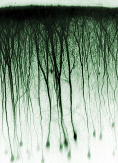 Nervenzellen im Gehirn. Zu sehen sind einzelne Neurone, die sich über ihre Zellfortsätze mit vielen anderen Nervenzellen vernetzen. Alexander Ecker, Jakob Reimer, Andreas Tolias / Max-Planck-Institut für biologische Kybernetik