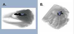 Bilder einzelner Scans von Fischgehirnen (blau = Region, die für Verarbeitung visueller Reize zuständig ist). A. Muräne. B. Fasanbutt. Quelle: Bilder aus Iglesias et al. 2018 (idw)