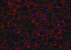 GPR81-Netzwerk auf Fettzellen. Die Fluoreszenzmikroskopie-Aufnahme zeigt einen Gewebsschnitt durch Fettgewebe. Die GPR81-Rezeptormoleküle sind rot, die Zellkerne der Fettzellen sind blau gefärbt. Bild: Max-Planck-Institut für Herz- und Lungenforschung