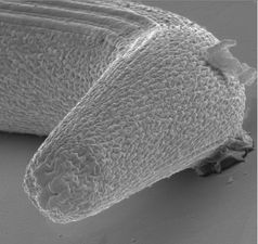 Vorderende einer infektiösen Strongyloides-Larve (Raster-EM-Aufnahme))
Quelle: (© Adrian Streit) (idw)