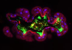 Fluoreszenz-Mikroskopie
Quelle: Martin Kaltenpoth, Max-Planck-Institut für chemische Ökologie (idw)