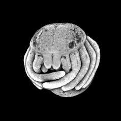 Spinnenembryo: Ansicht des sich entwickelnden Kopfes.
Quelle: Foto: Universität Göttingen (idw)