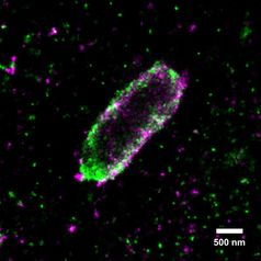 Ein Salmonellen-Bakterium in einer menschlichen Zelle, umgeben von einem Mantel aus verschiedenartige Ubiquitin-Ketten. Quelle: Mike Heilemann/Ivan Dikic (idw)
