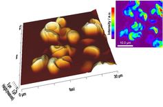 Dreidimensionale rasterkraftmikroskopische Abbildung eines Blutgerinnsel aus Ötzis Rückenwunde und spektroskopische Aufnahme der selben Stelle. (Ery Haufen 19441 3D both)
Quelle: Bild: Marek Janko (idw)