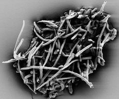 Aufnahme der Mykorrhizaoberfläche mit einem Rasterelektronenmikroskop.
Quelle: Foto: Uni Göttingen (idw)