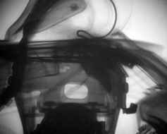 Airbagzündung mit anschließender Luftsackentfaltung und Klappenöffnung. Röntgen-Kinematografie-Bilder zu zwei ausgewählten Zeitpunkten. © Fraunhofer EMI