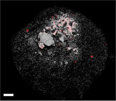Epifluoreszenzmikroskopisches Bild von Methanoliparia-Zellen, die an einem Öltröpfchen haften. Die weiße Maßstabsleiste hatte eine Länge von 10 Mikrometern.