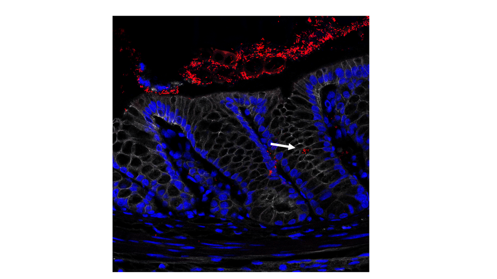Entzündeter Dickdarm: Zellkerne in blau, Zellmembranen in weiß. In rot die Bakterien, die das gesamte Mikrobiom darstellen. Der Pfeil zeigt auf die Bakterien, die in die Krypten gelangt sind.