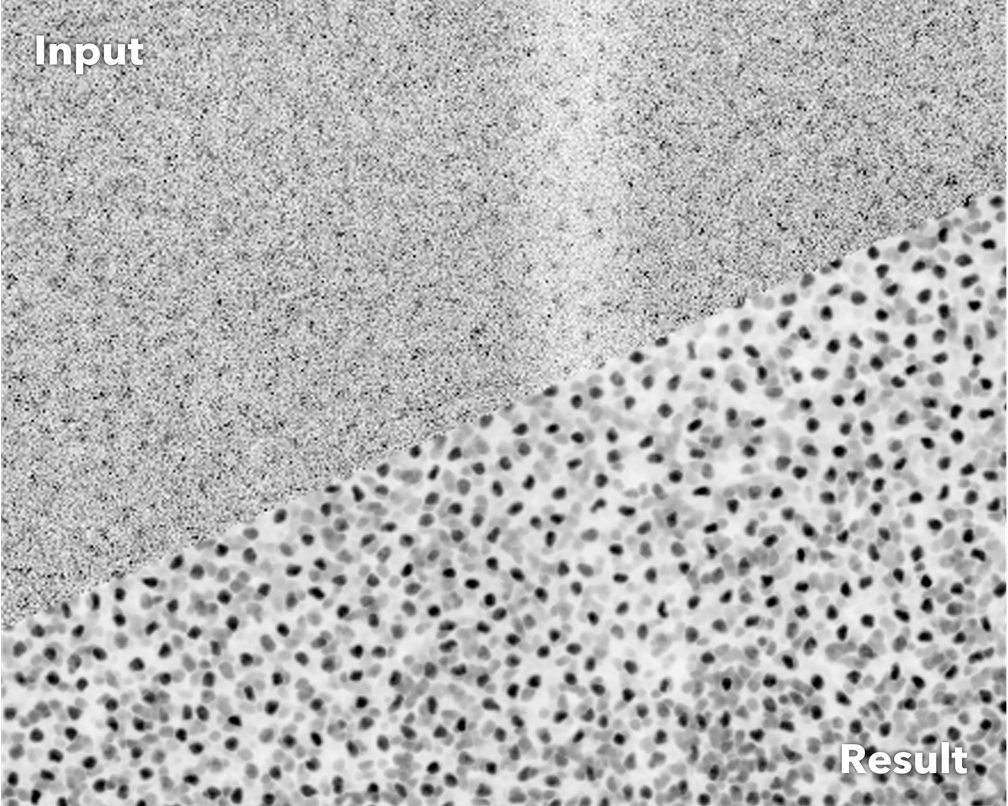 Verrauschte Fluoreszenz-Mikroskopie-Aufnahme von Zellkernen des Plattwurmes Schmidtea mediterranea (oben) und nach der Bearbeitung durch CARE (unten)
Quelle: © Martin Weigert, Tobias Boothe und Deborah Schmidt/MPI-CBG, CSBD (idw)