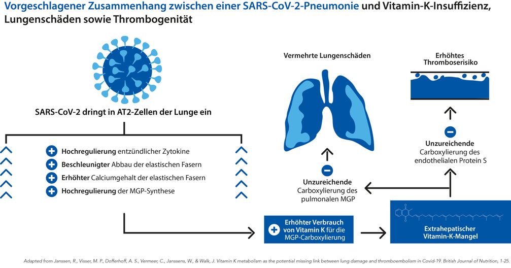Zusammenhang zwischen einer SARS-CoV-2-Pneunomie und Vitamin-K-Insuffizienz, Lungenschäden sowie Thrombogenität  Bild: Dr. Jacobs Institut Fotograf: Dr. Jacobs Institut