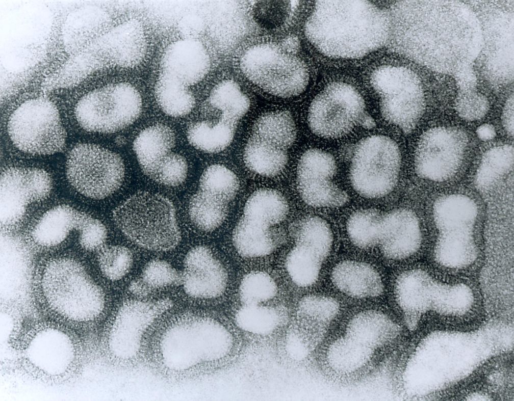 Aviäres Influenzavirus (HPAIV), elektronenmikroskopische Aufnahme.
