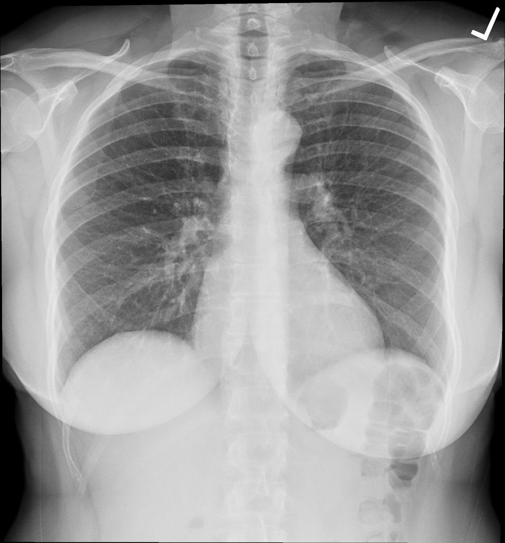 Röntgenbild (Symbolbild)